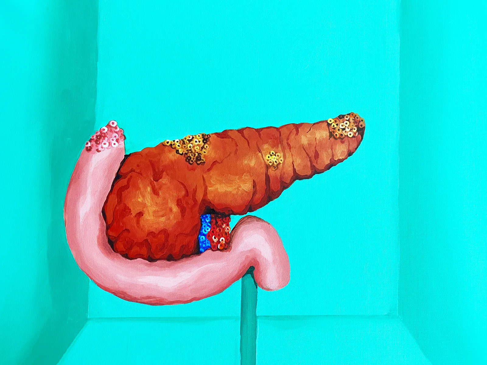 Pancreas, 2019, by Somalee Banerjee